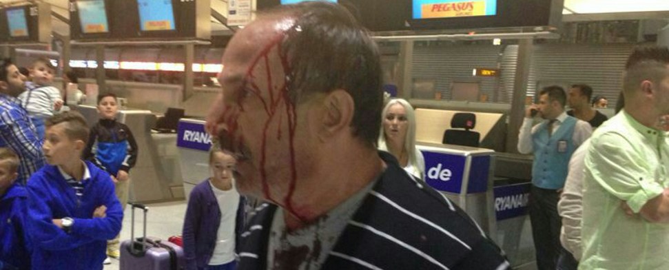 Türkischer Familienvater zusammengeschlagen – Staatsanwalt ermittelt