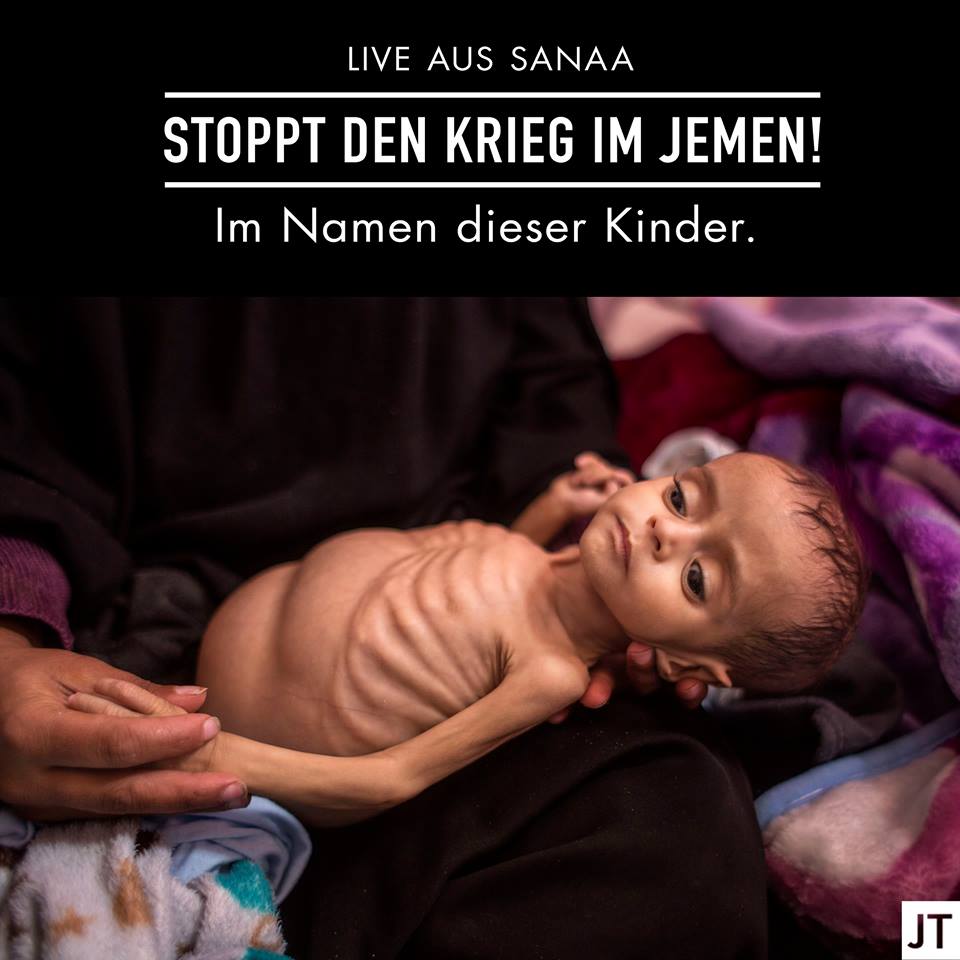 Todenhöfer: Jemen erlebt schlimmste Hungersnot seit 100 Jahren