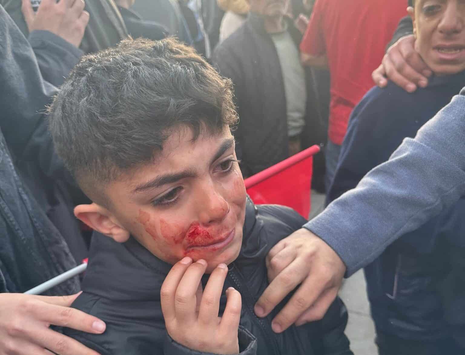 Türkei: Beliebter Oppositionspolitiker İmamoğlu mit Steinen beworfen