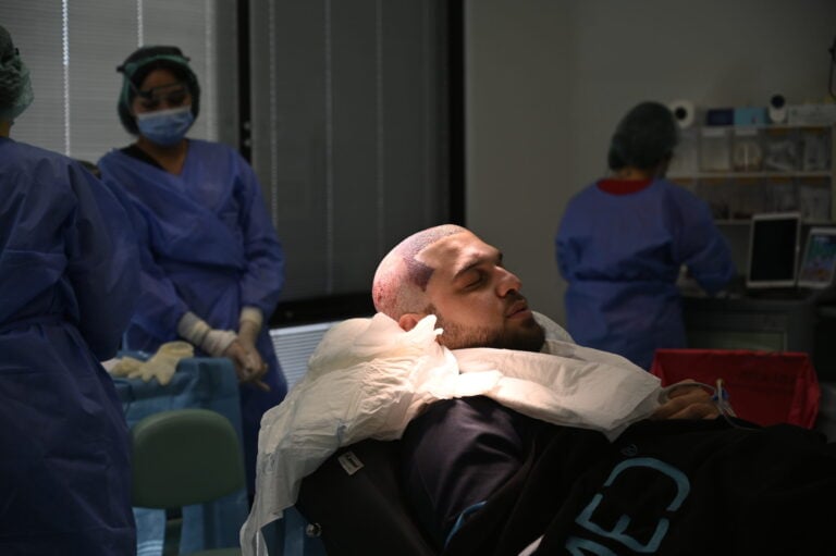 Haartransplantation in der Türkei: Das Geschäft mit der Glatze